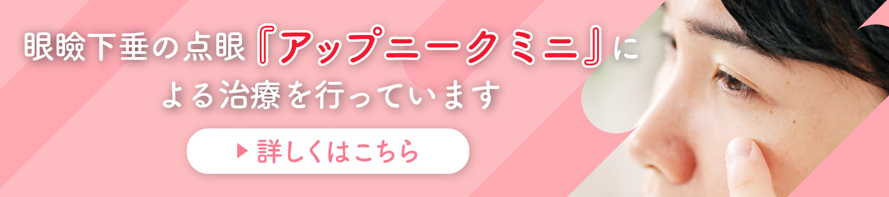 アップニークミニ
